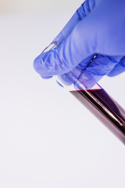 Diagnostic Test Results
