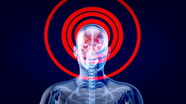 Intellectual Property