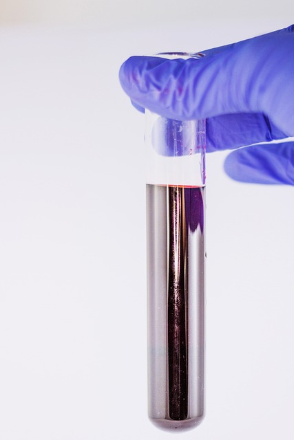 Diagnostic Test Results