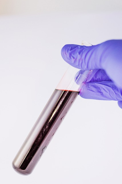 Diagnostic Test Results