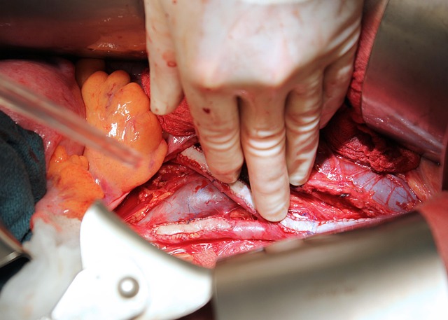 Internal Financial Policies and Procedures