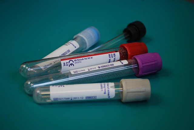 Diagnostic Test Results