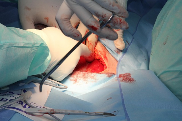 Surgical Procedure Instructions
