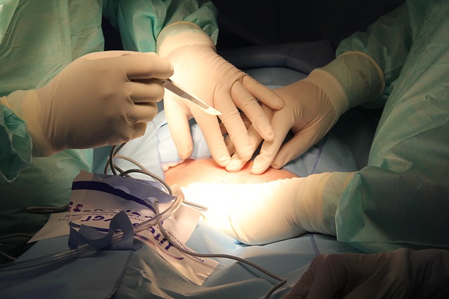Surgical Procedure Instructions
